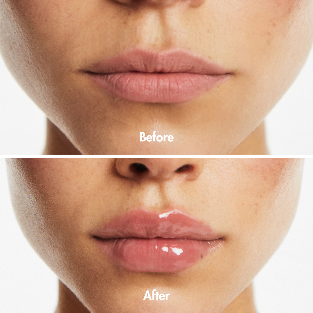 Triple Lip Plumper Bundle
