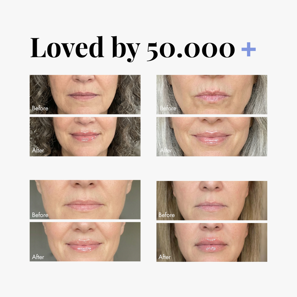Normal Lip Plumper