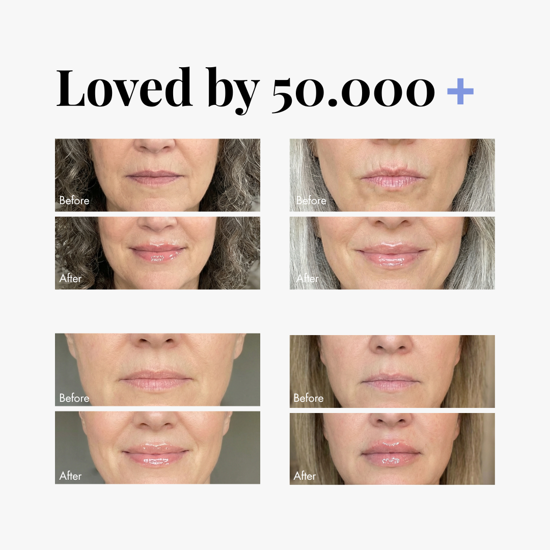 Normal Lip Plumper